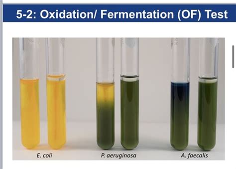 oxidation fermentation test|acid from glucose test microbiology.
